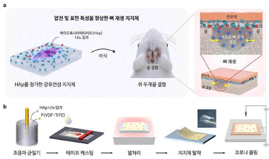 뼈 재생을 촉진하는 뼈 반창.jpg