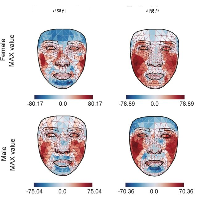 고혈압과 지방간 질환을 앓은 남녀의 얼굴 온도 분포 차이.png